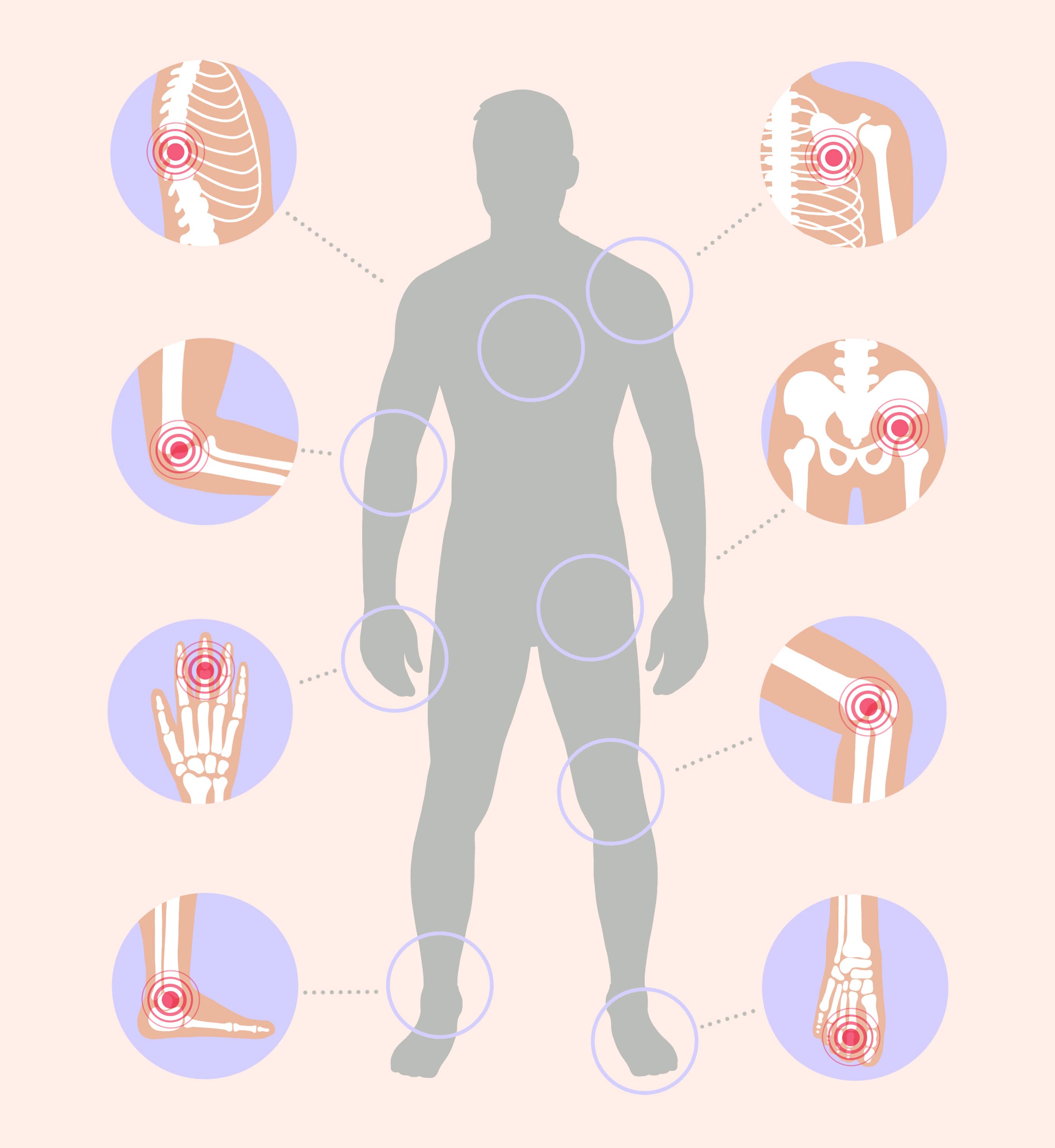 Douleurs articulaires causes